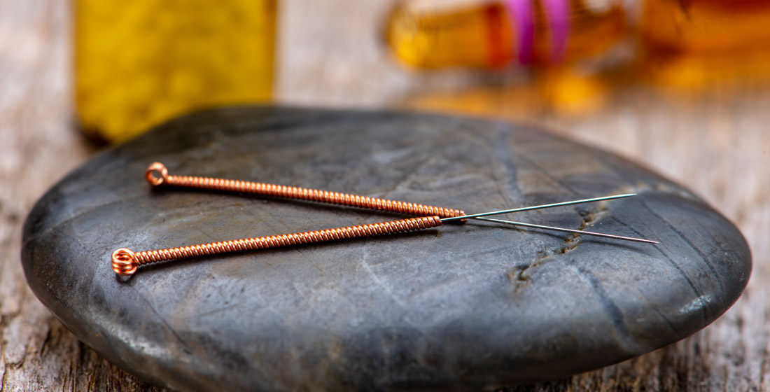 Exploring the Synergy: Homeopathy and Acupuncture